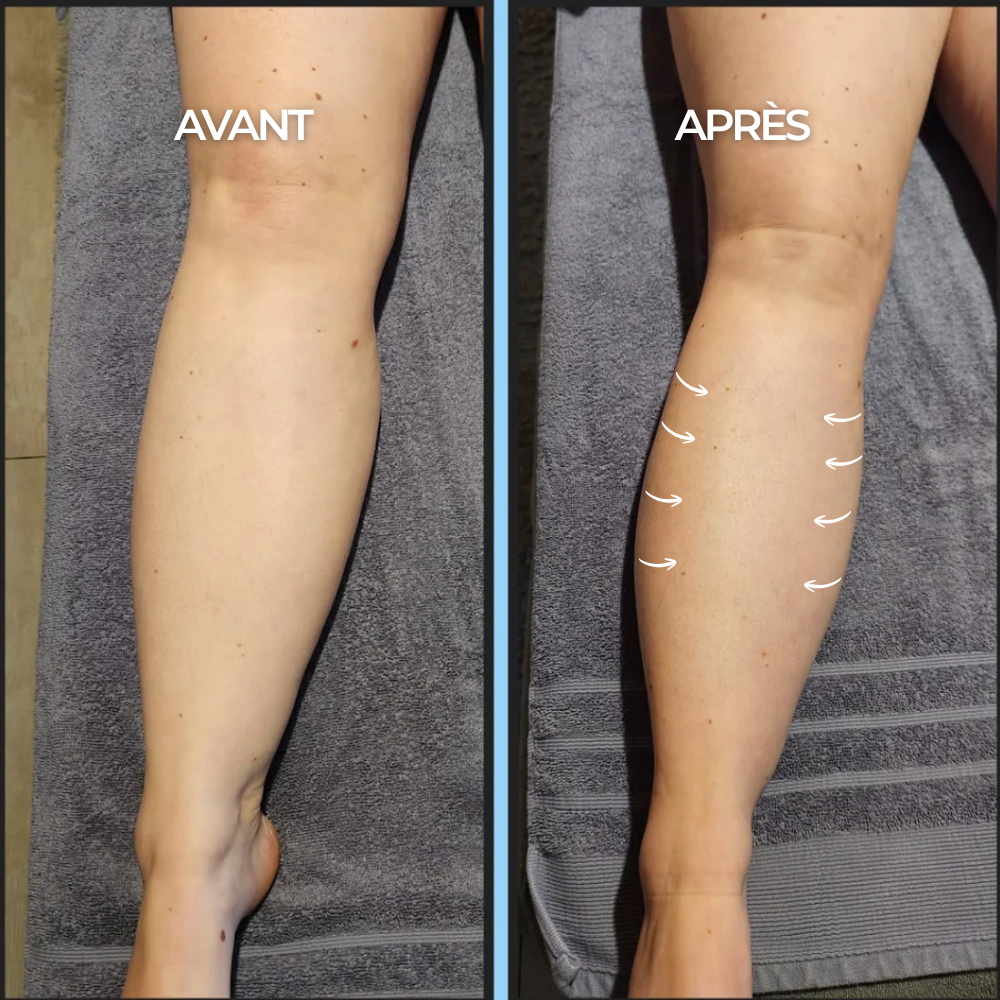 Gocce Benessere Drenaggio Linfatico - 35 ml