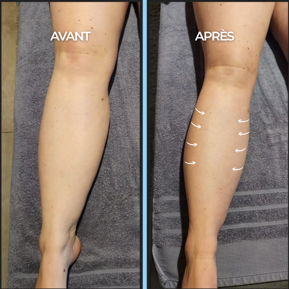 Chaussettes de Compression - Maison Lys