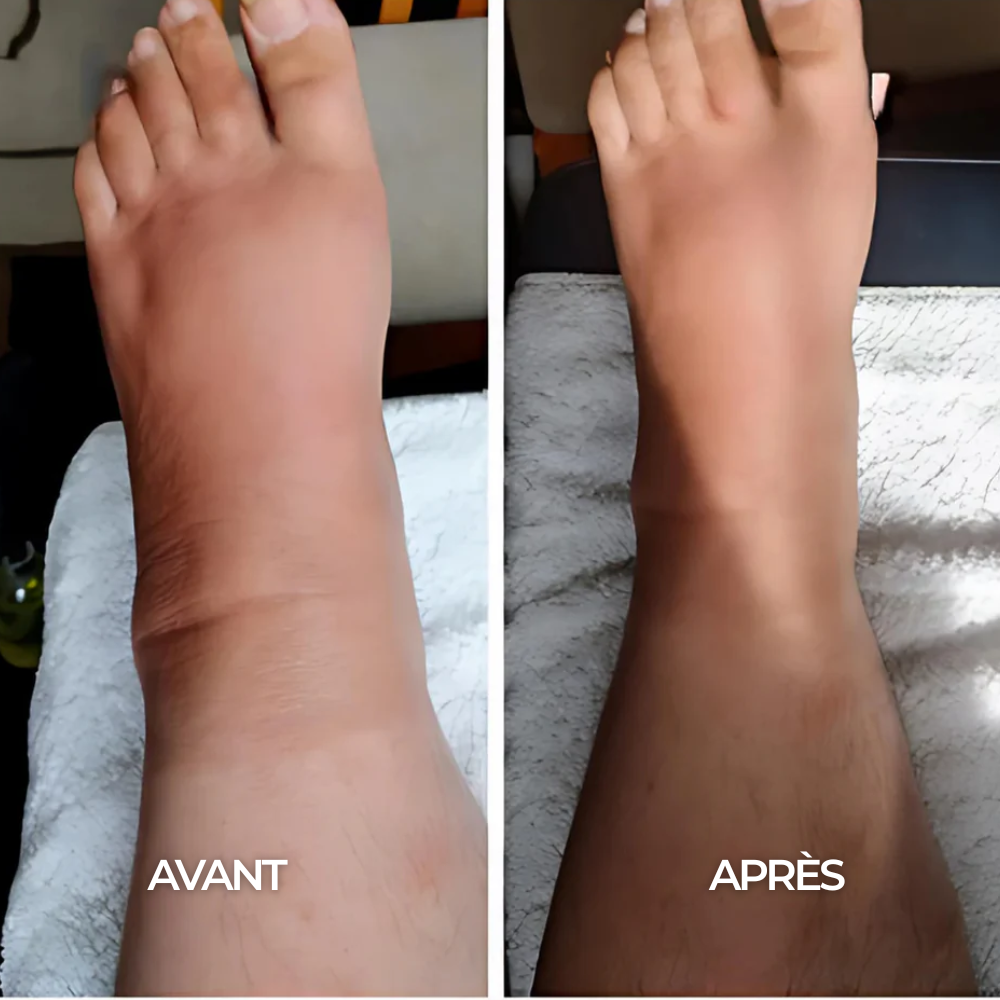 Chaussettes de Compression - Maison Lys