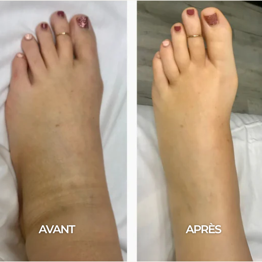 Chaussettes de Compression - Maison Lys