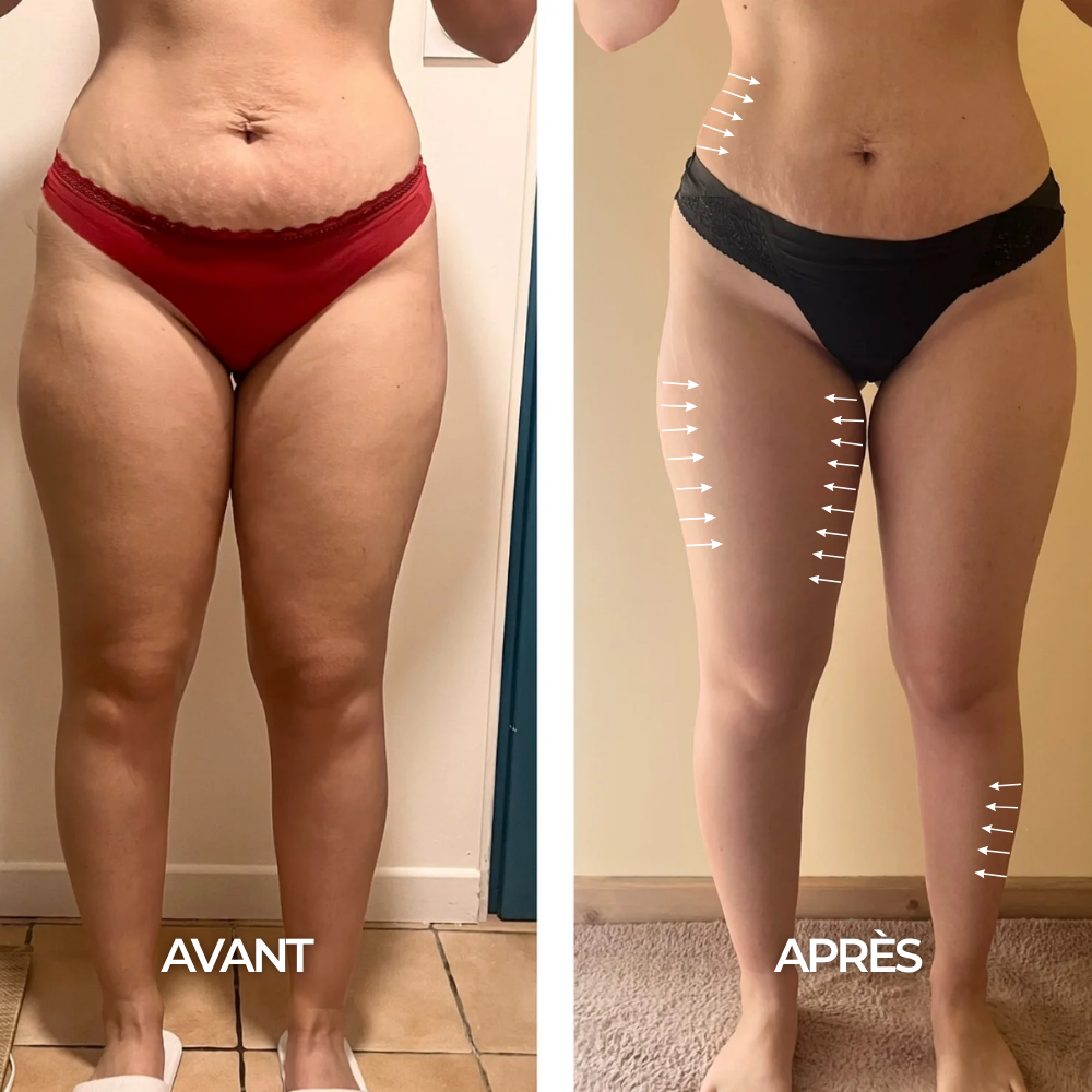 Gocce Benessere Drenaggio Linfatico - 35 ml