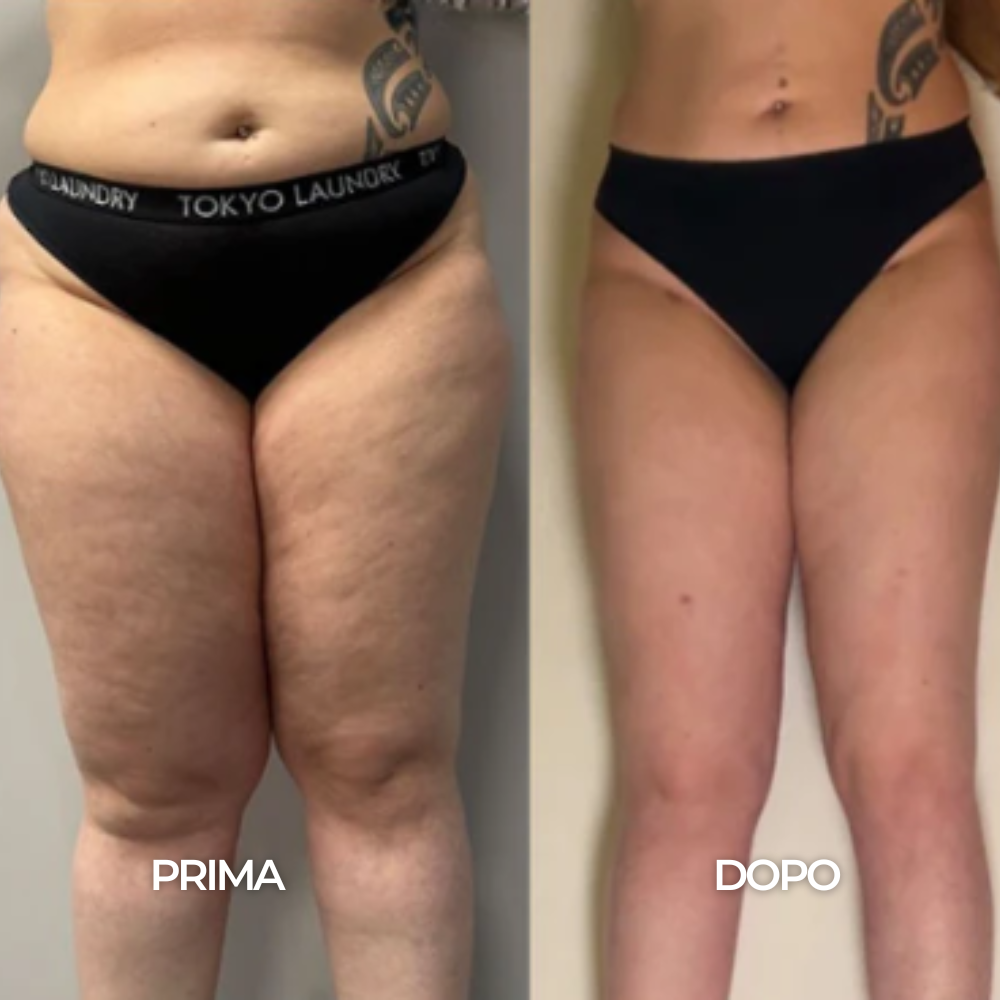 Gocce Benessere Drenaggio Linfatico - 35 ml